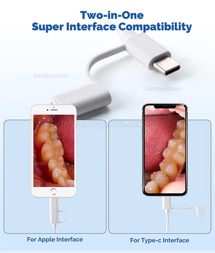 Dental Digitale Intraoralkamera Typ-C /Micro USB 2in1, 2,0MP Pixel